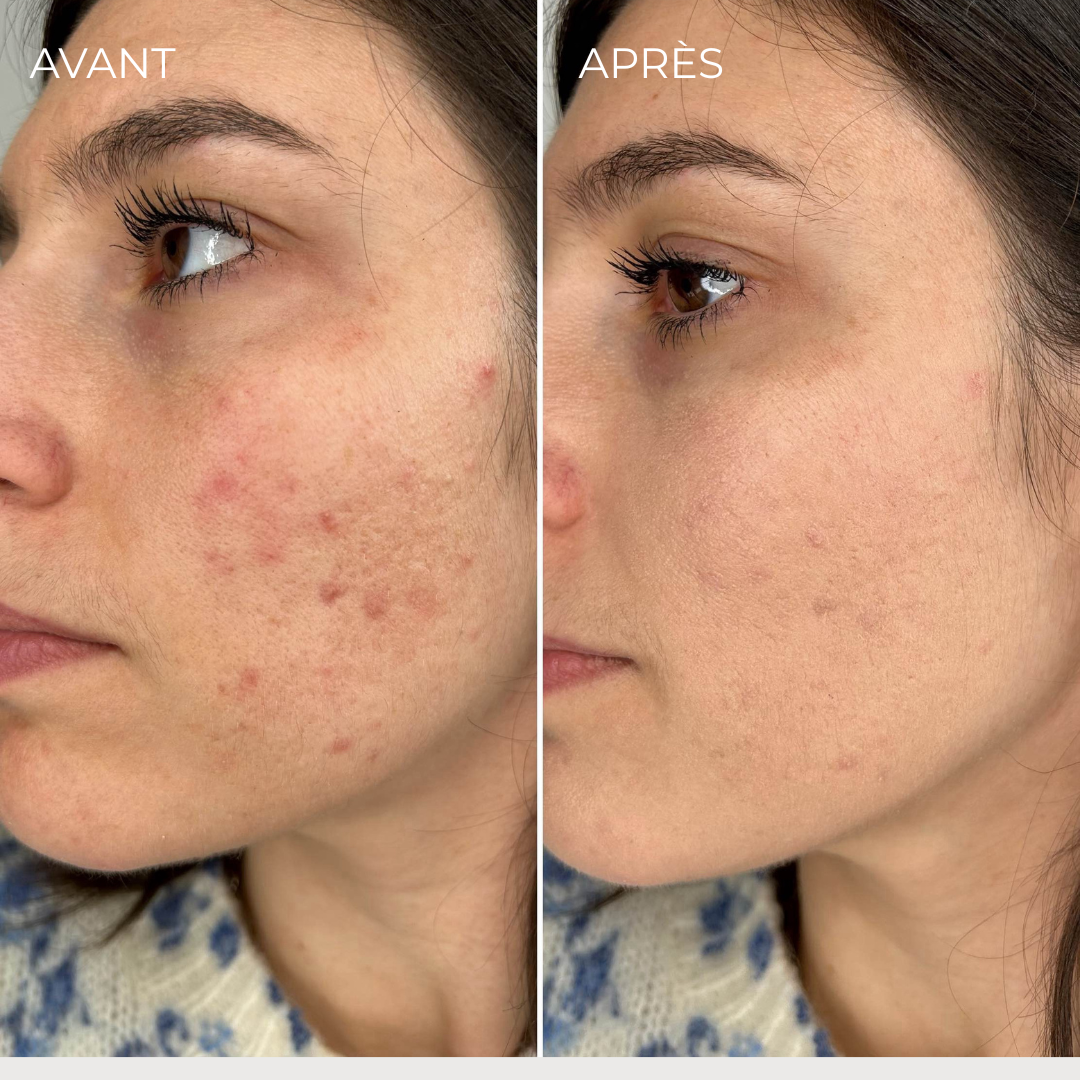 Flawless BB crème – Soin Anti-Imperfections