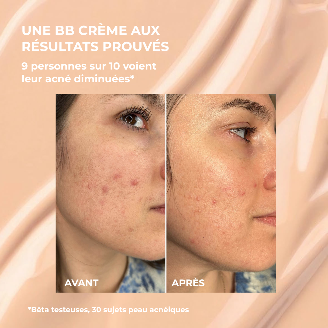 Échantillon BB Crème anti-imperfections