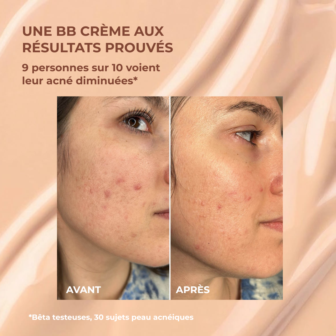 BB crème soin anti-imperfections